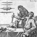 La primera transfusión de sangre la realizó Jean-Baptiste Denys el 15 de junio de 1667