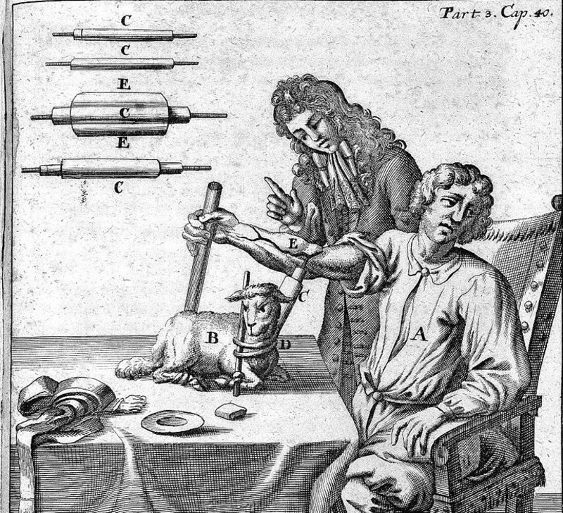 Primera transfusión sanguínea el 15 de junio de 1667, por Jean Baptiste Denys