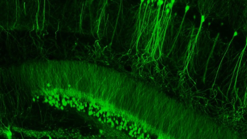 Por qué el cannabis afecta a la plasticidad de los circuitos neuronales