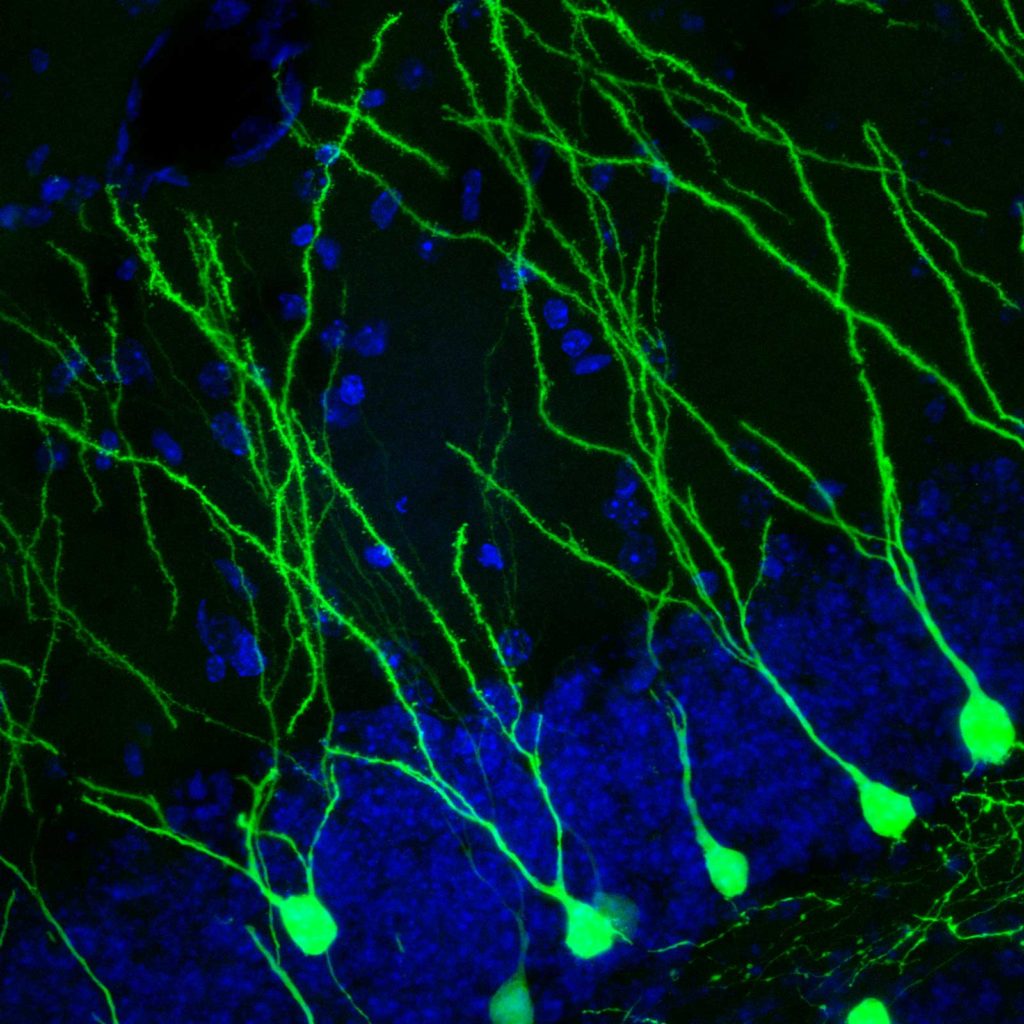 Neurogenesis- Henriette van Praag y Linda Kitabayashi