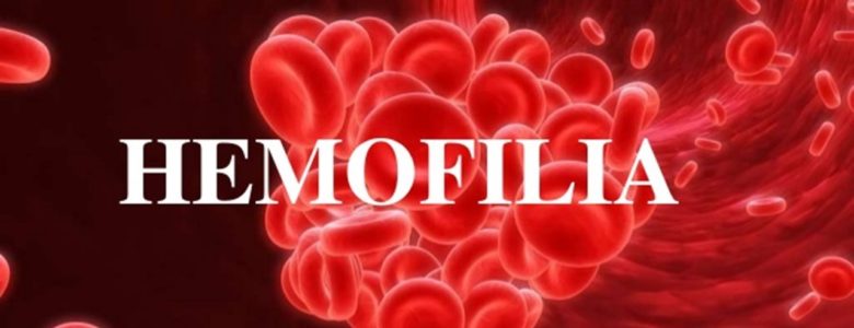 Hemofilia- UCJC