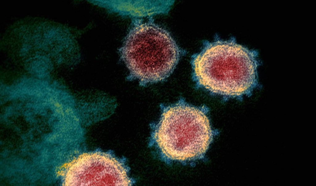 Coronavirus SARS-CoV-2, causante de la enfermedad COVID-19- NIAID-RML