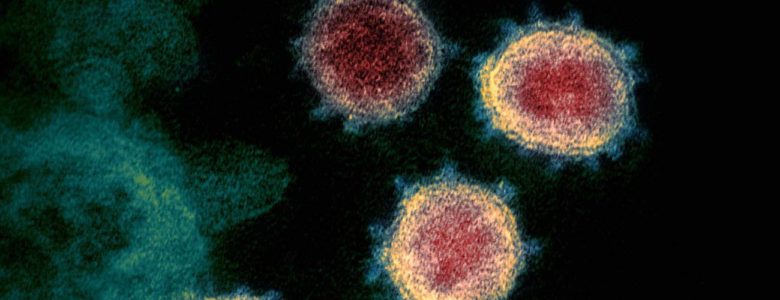 Coronavirus SARS-CoV-2, causante de la enfermedad COVID-19- NIAID-RML